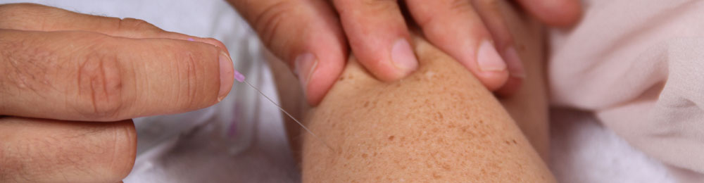 NEEDLING / ACCUPUNCTURE