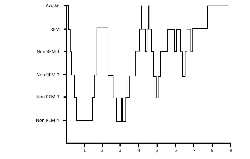 REM sleep gram1
